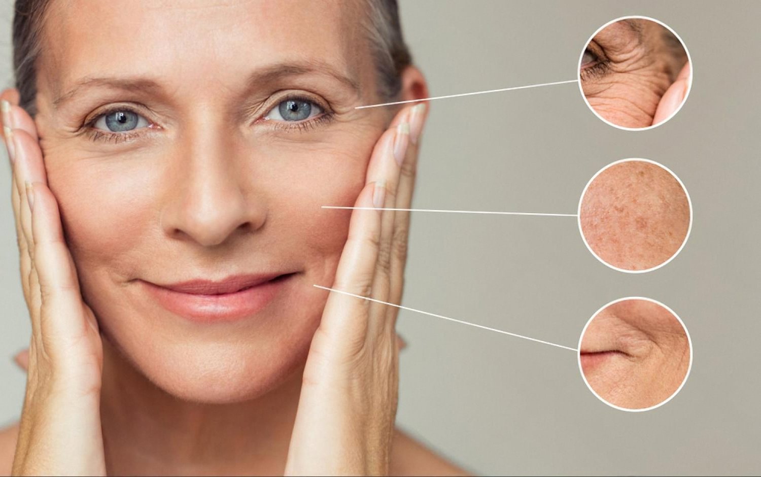 Woman's face with zoomed circles highlighting wrinkles, sun spots and loss of firmness caused by daily habits